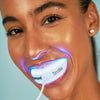 Nainen, jolla on suukappale Diamond Smile PAP+-hampaiden valkaisusarjan suussa.