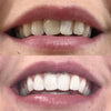 Whitening Suuvesi iD+