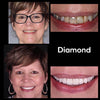 Whitening Suuvesi iD+