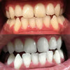 Kokemuksia Diamond Smile hampaiden valkaisusta PAP+ jauhe - suu ennen ja jälkeen kuva valkoisista hampaista