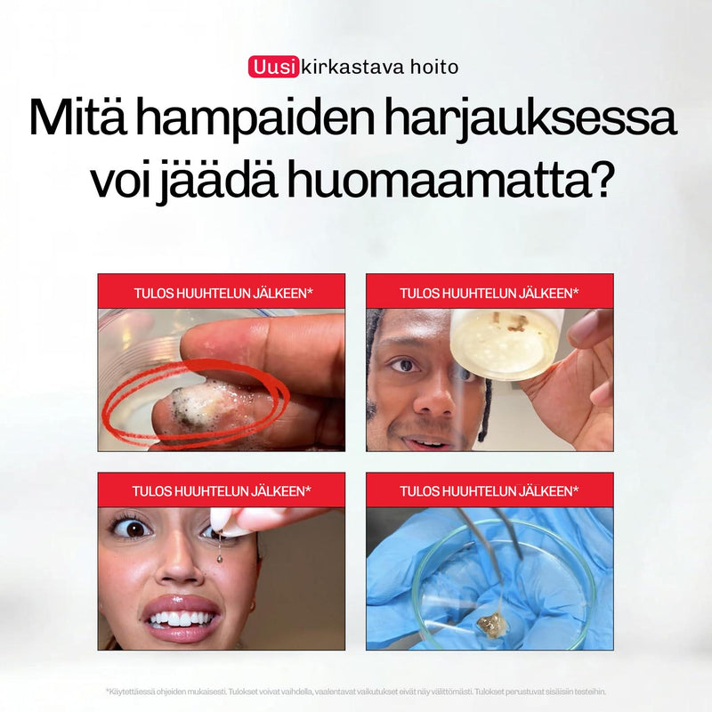 Whitening Suuvesi iD+