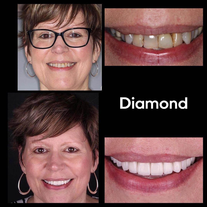 Whitening Suuvesi iD+